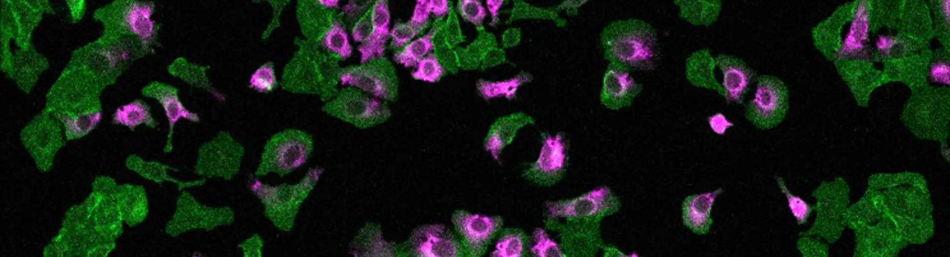 Cells exposed to ultrasound