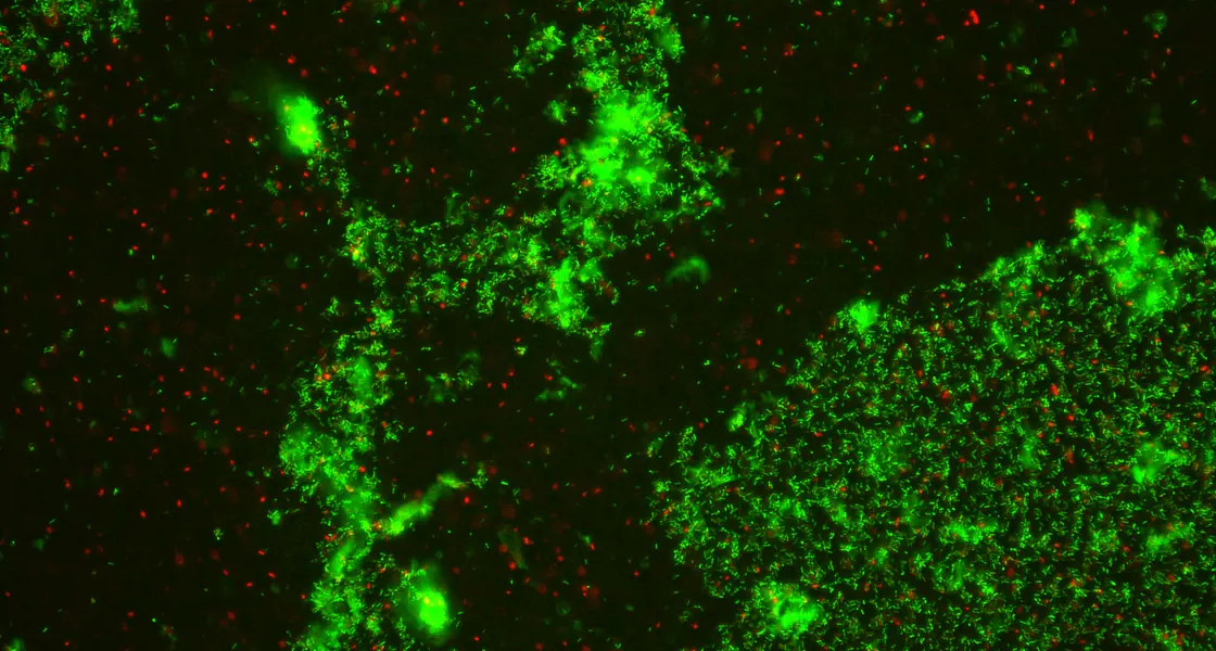 Biofilm reduction following ultrasound exposure
